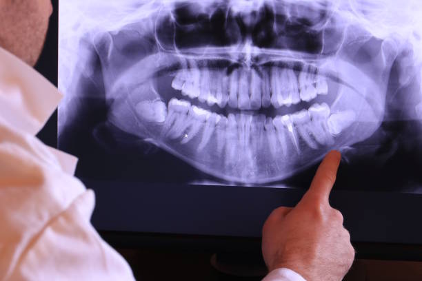 Best Emergency Care for Gum Disease in Loving, NM